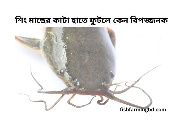 শিং মাছের কাটা হাতে ফুটলে করণীয়